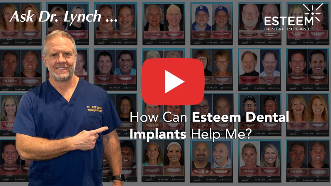 dr lynch how dental implants help video poster